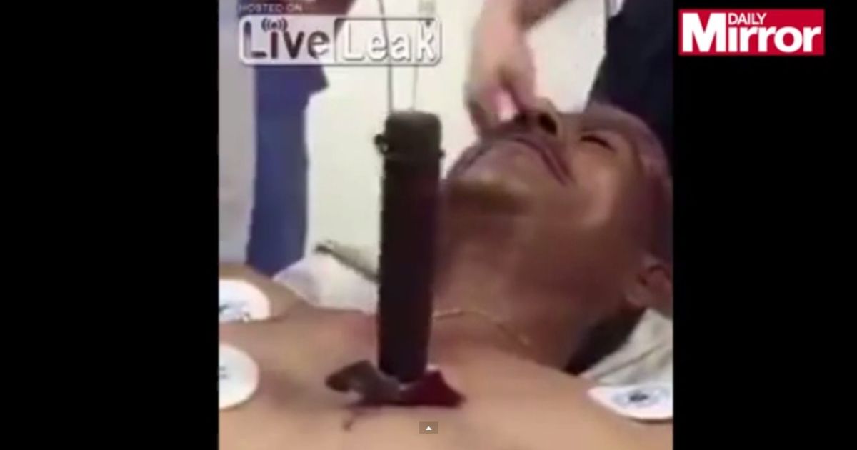 Нож вонзили в опасной близости от сердца