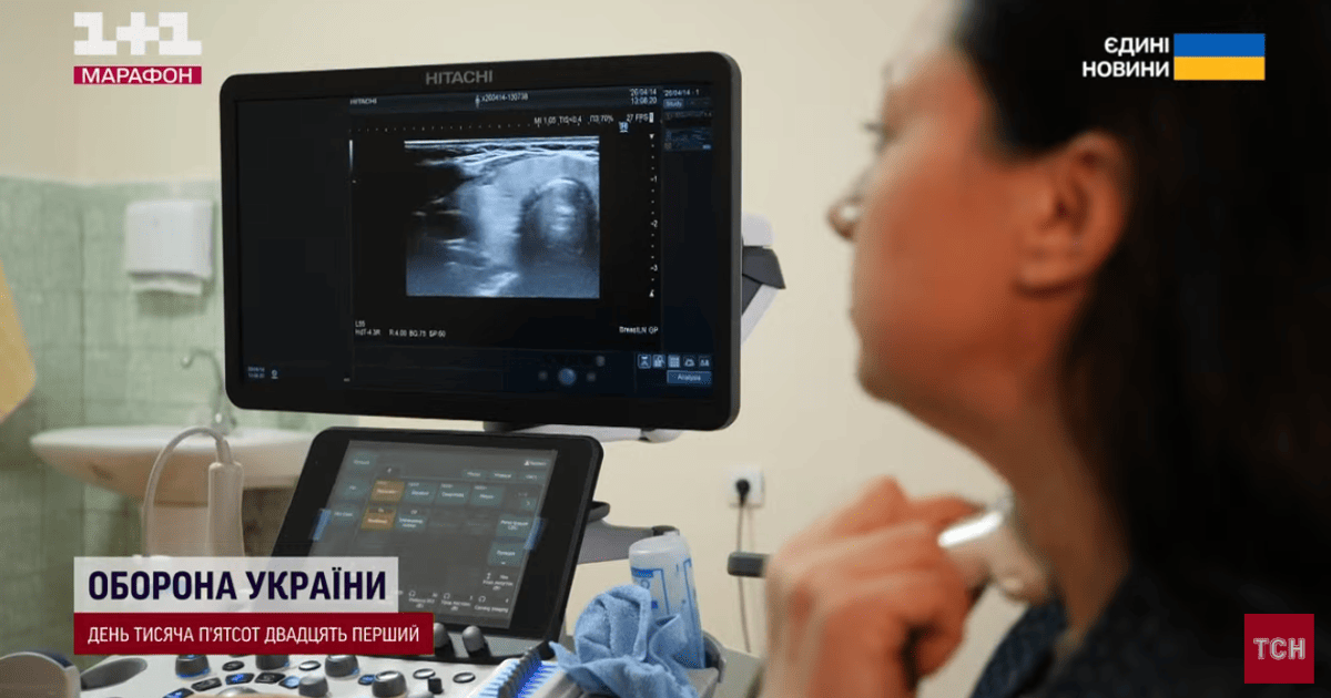 В Україні стався спалах раку щитоподібної залози