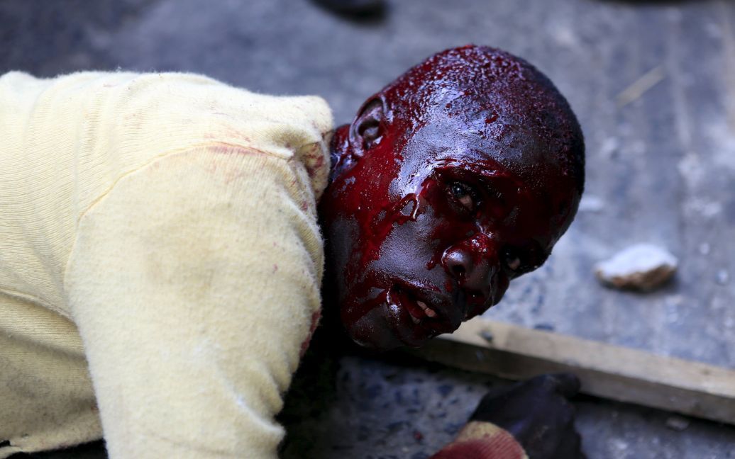 Окровавленный мужчина лежит после того, как его избили, подозревая в краже мобильного телефона во время оппозиционного митинга в столице Кении Найроби. / © Reuters