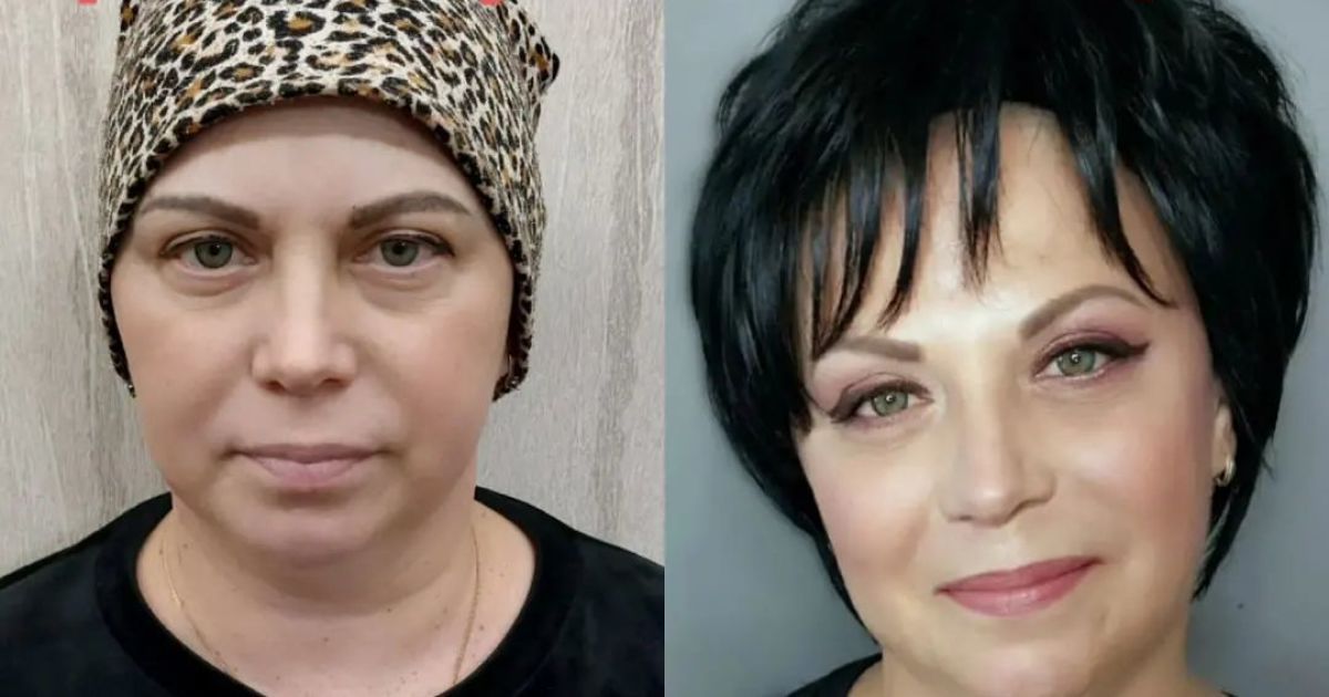 Лікарі в Туреччині готові взятись за лікування Світлани, але потрібні кошти