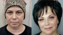 Лікарі в Туреччині готові взятись за лікування Світлани, але потрібні кошти