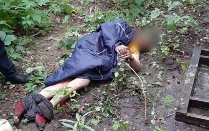 В Киеве мужчина три дня пролежал в кустах, потому что не мог подняться из-за боли в спине