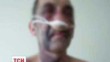 В Фастове выздоровела семья, которую месяц назад избили прямо на улице
