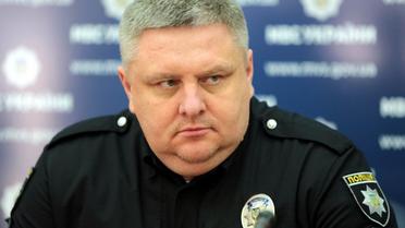 В МВД рассказали о состоянии инфицированного коронавирусом начальника полиции Киева