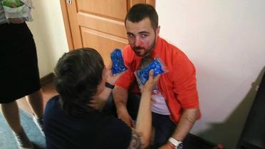 В Одессе неизвестные среди белого дня обстреляли съемочную группу местного телеканала