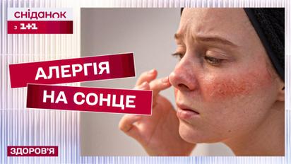 Не пропустите эти симптомы! Как распознать аллергию на солнце? Советы дерматолога